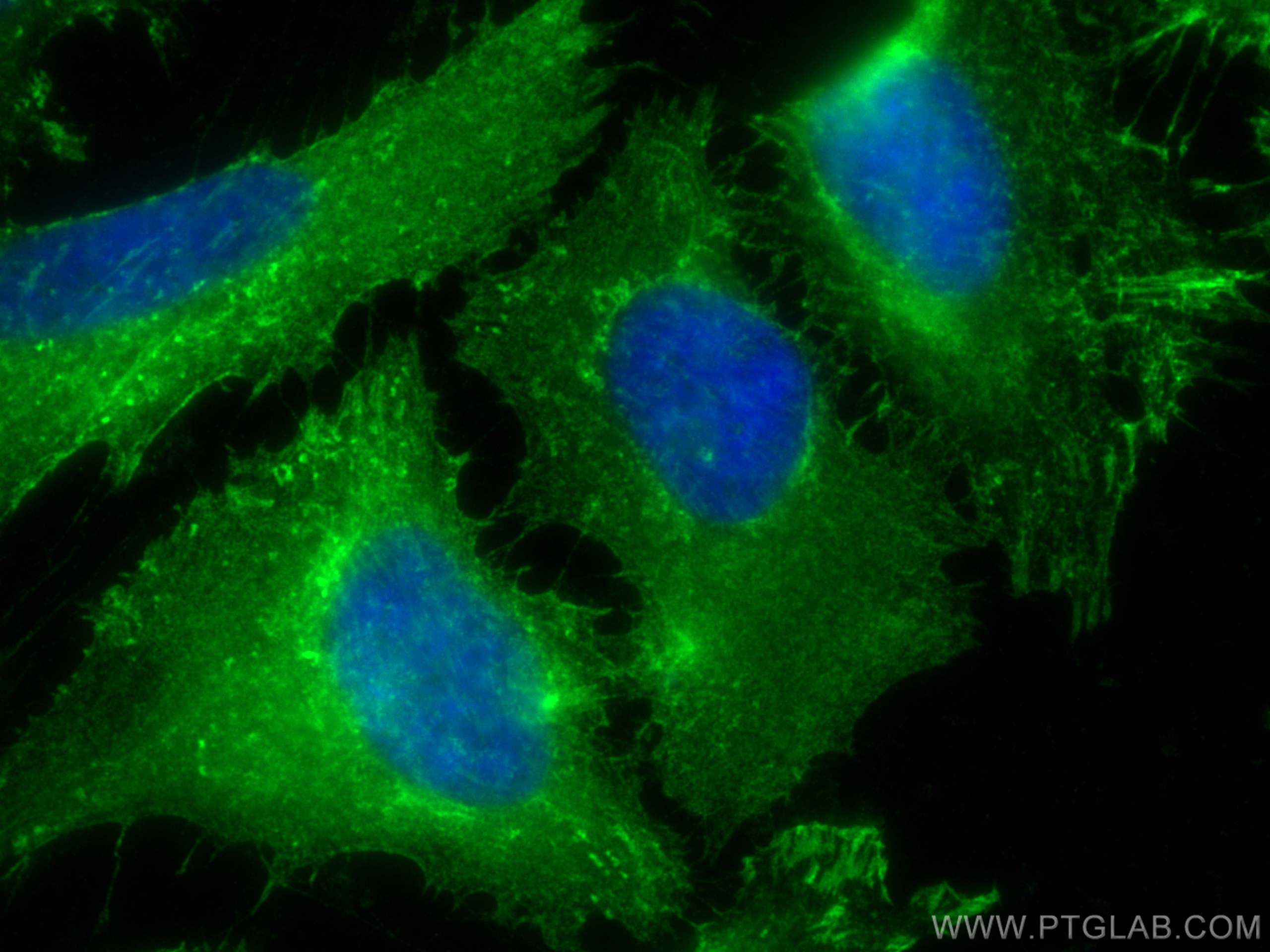 Immunofluorescence (IF) / fluorescent staining of HeLa cells using Drebrin Polyclonal antibody (10260-1-AP)