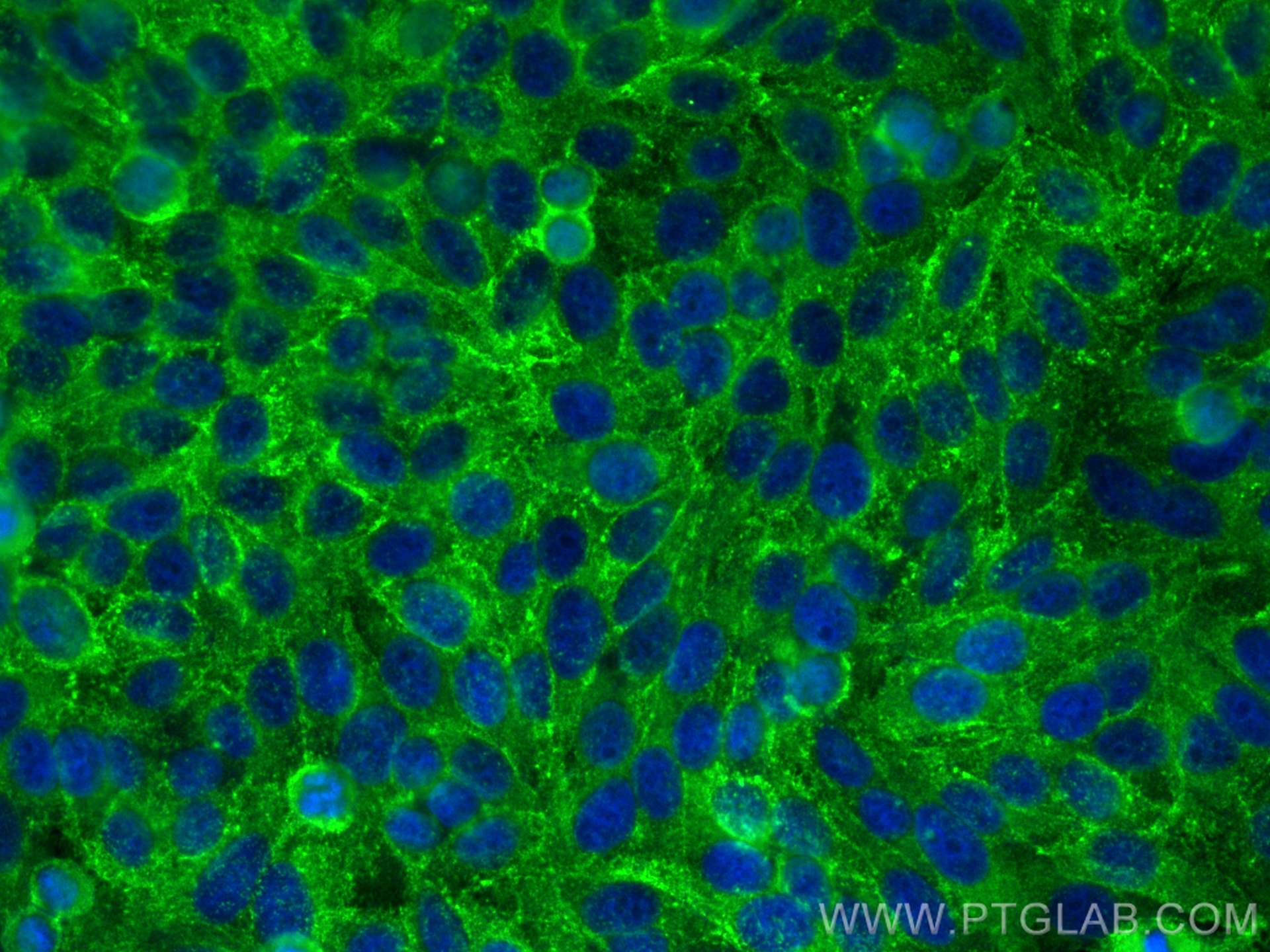 Immunofluorescence (IF) / fluorescent staining of HepG2 cells using Drebrin Polyclonal antibody (10260-1-AP)