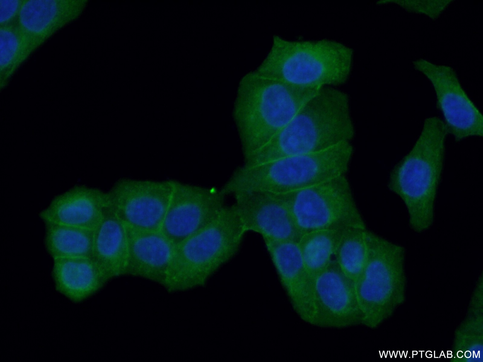 Immunofluorescence (IF) / fluorescent staining of HeLa cells using Drebrin Polyclonal antibody (10260-1-AP)