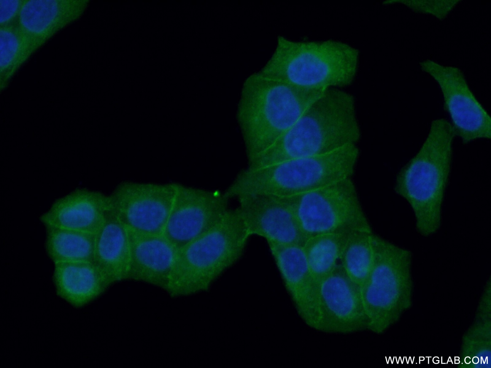 IF Staining of HeLa using 10260-1-AP