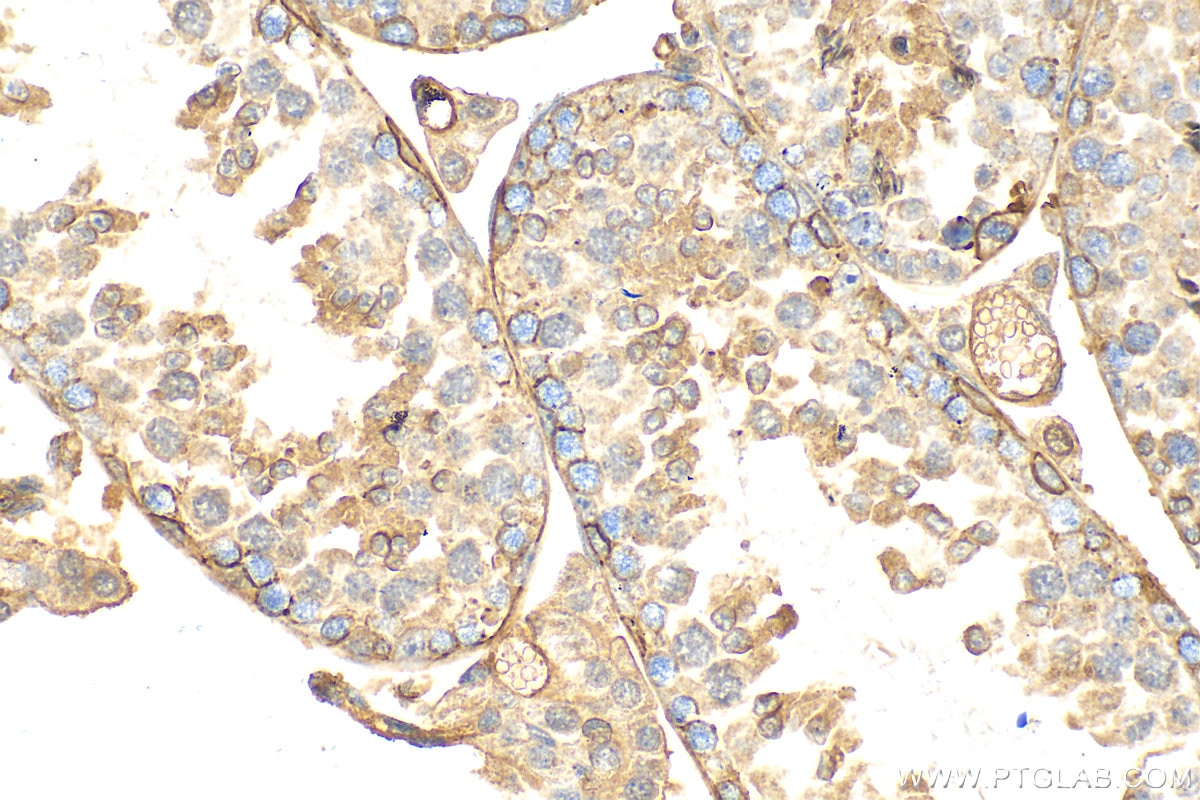 Immunohistochemistry (IHC) staining of mouse testis tissue using Drebrin Polyclonal antibody (10260-1-AP)