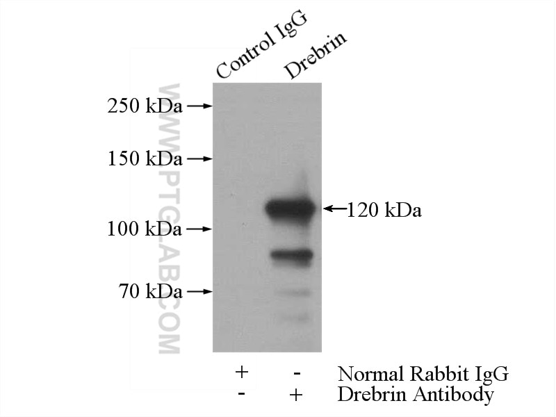 Immunoprecipitation (IP) experiment of K-562 cells using Drebrin Polyclonal antibody (10260-1-AP)