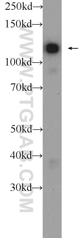 Western Blot (WB) analysis of K-562 cells using Drebrin Polyclonal antibody (10260-1-AP)