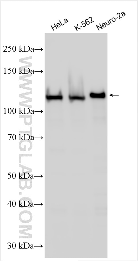 Western Blot (WB) analysis of various lysates using Drebrin Polyclonal antibody (10260-1-AP)