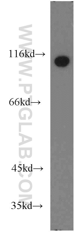 Western Blot (WB) analysis of HeLa cells using Drebrin Polyclonal antibody (10260-1-AP)