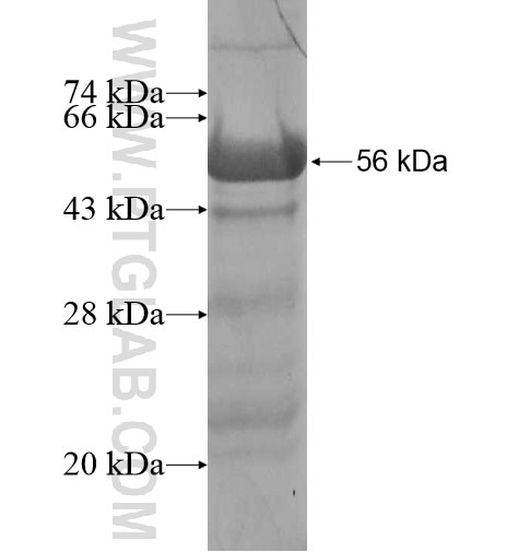 DBNDD1 fusion protein Ag13794 SDS-PAGE