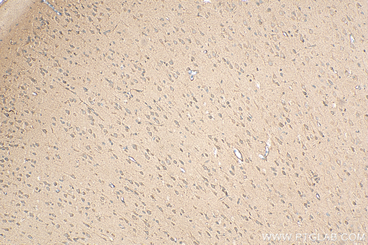 Immunohistochemistry (IHC) staining of rat brain tissue using DBNDD2 Polyclonal antibody (27623-1-AP)