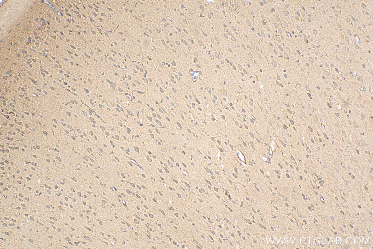 IHC staining of rat brain using 27623-1-AP