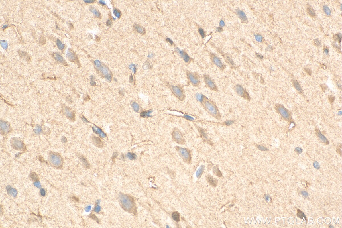 Immunohistochemistry (IHC) staining of rat brain tissue using DBNDD2 Polyclonal antibody (27623-1-AP)