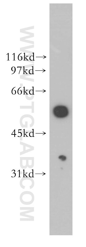 Western Blot (WB) analysis of HeLa cells using HIP55 Polyclonal antibody (13015-1-AP)