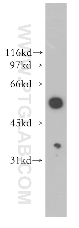 Western Blot (WB) analysis of HeLa cells using HIP55 Polyclonal antibody (13015-1-AP)