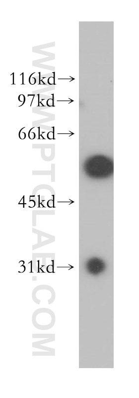 Western Blot (WB) analysis of K-562 cells using HIP55 Polyclonal antibody (13015-1-AP)