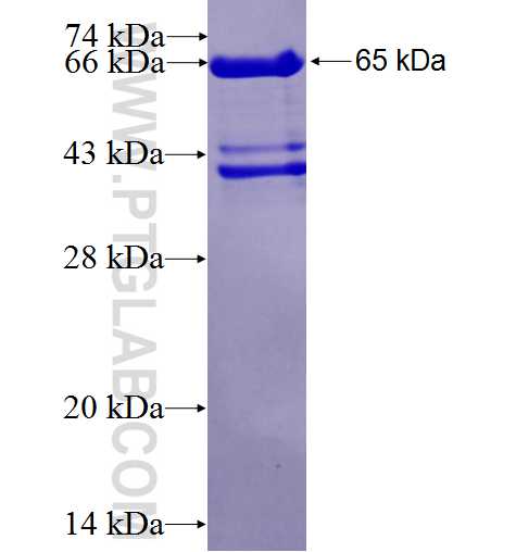 DBNL fusion protein Ag4078 SDS-PAGE