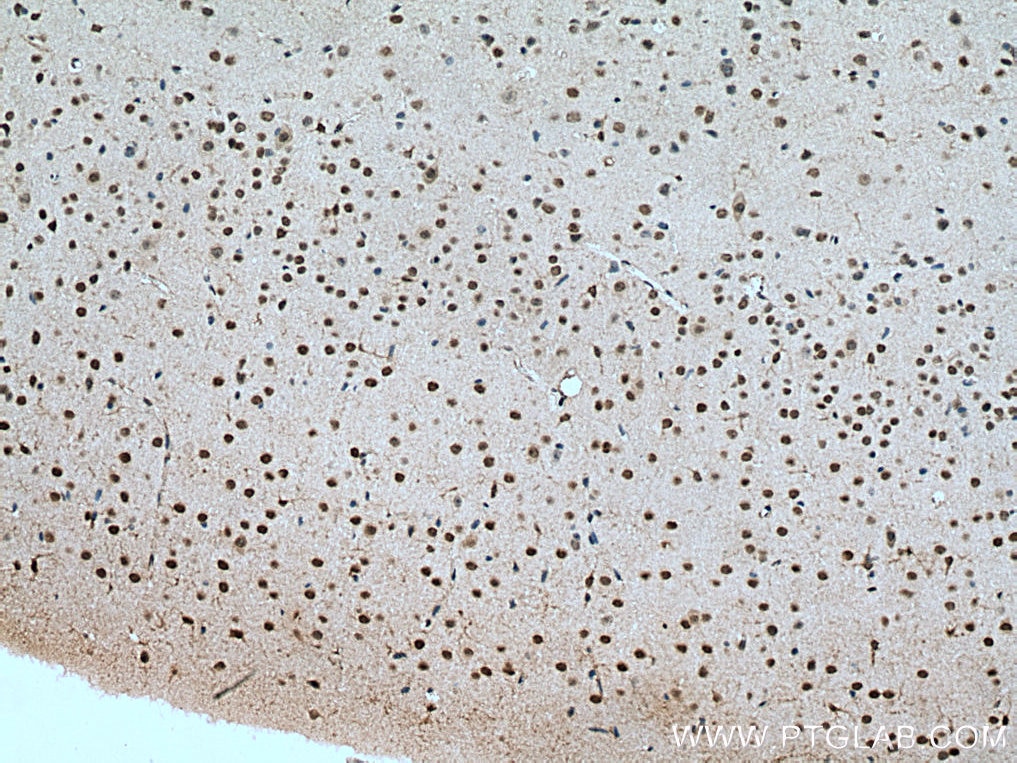 Immunohistochemistry (IHC) staining of mouse brain tissue using DBP Polyclonal antibody (12662-1-AP)