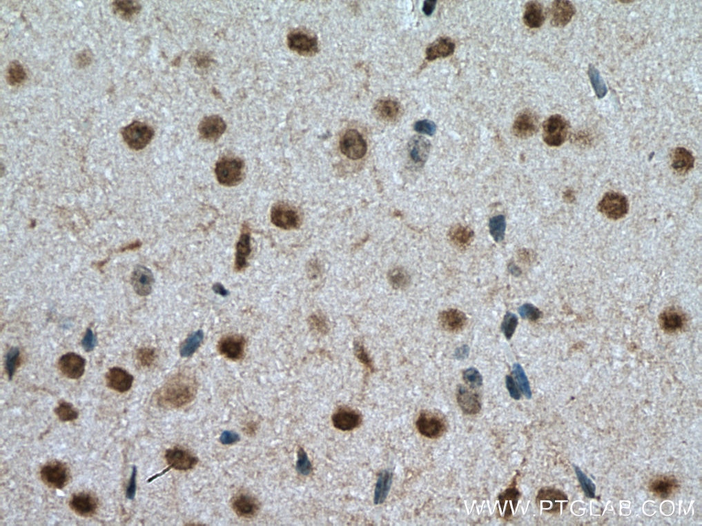 Immunohistochemistry (IHC) staining of mouse brain tissue using DBP Polyclonal antibody (12662-1-AP)