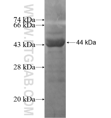 DBP fusion protein Ag14692 SDS-PAGE