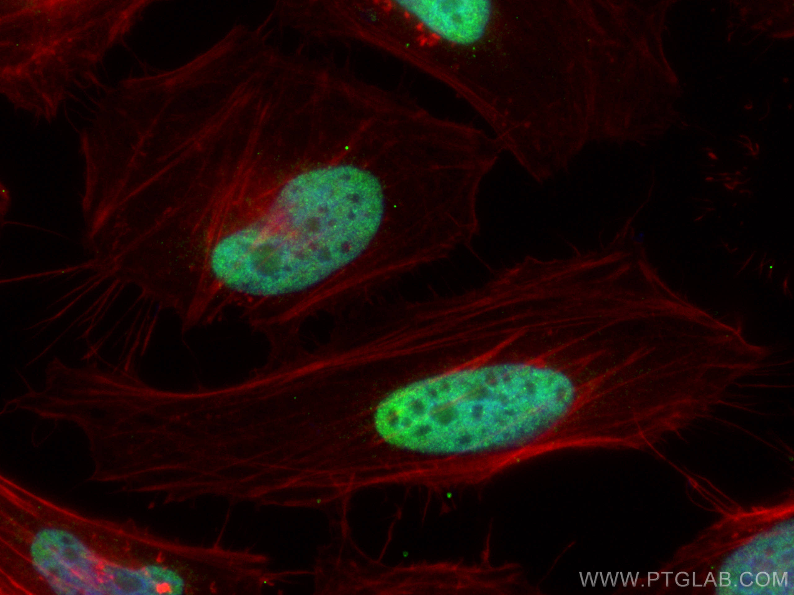 Immunofluorescence (IF) / fluorescent staining of HeLa cells using DBR1 Polyclonal antibody (16019-1-AP)