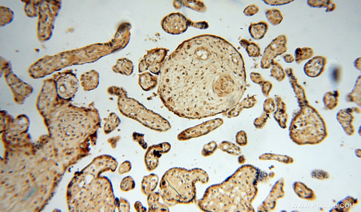 Immunohistochemistry (IHC) staining of human placenta tissue using DBR1 Polyclonal antibody (16019-1-AP)