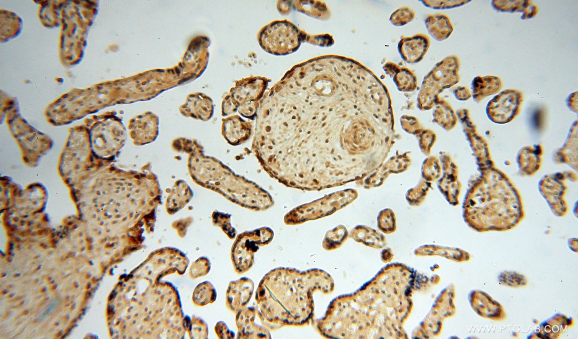 IHC staining of human placenta using 16019-1-AP