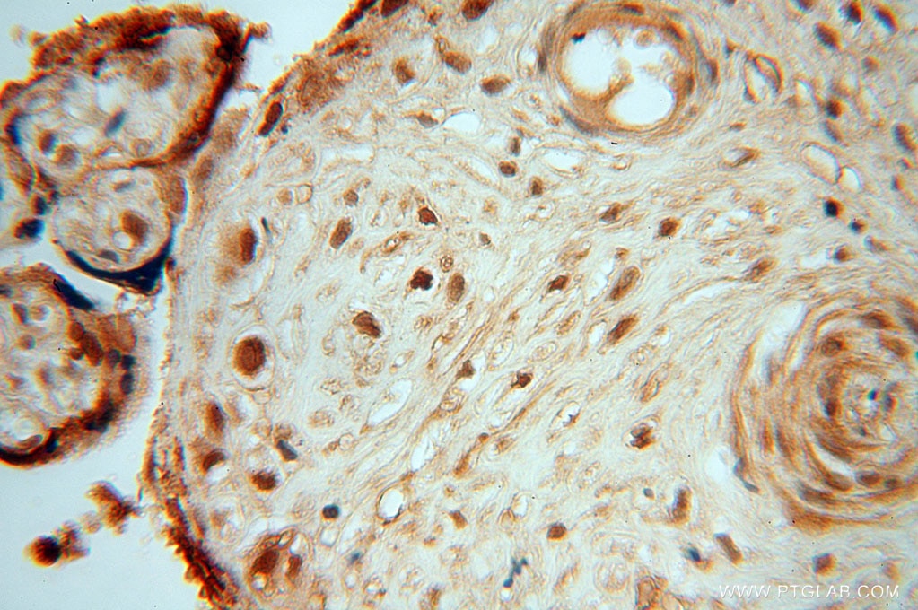 Immunohistochemistry (IHC) staining of human placenta tissue using DBR1 Polyclonal antibody (16019-1-AP)