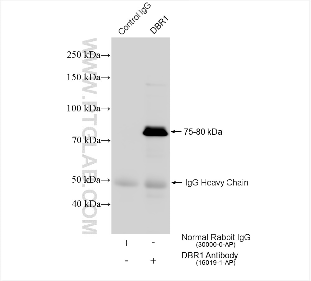 Immunoprecipitation (IP) experiment of HeLa cells using DBR1 Polyclonal antibody (16019-1-AP)