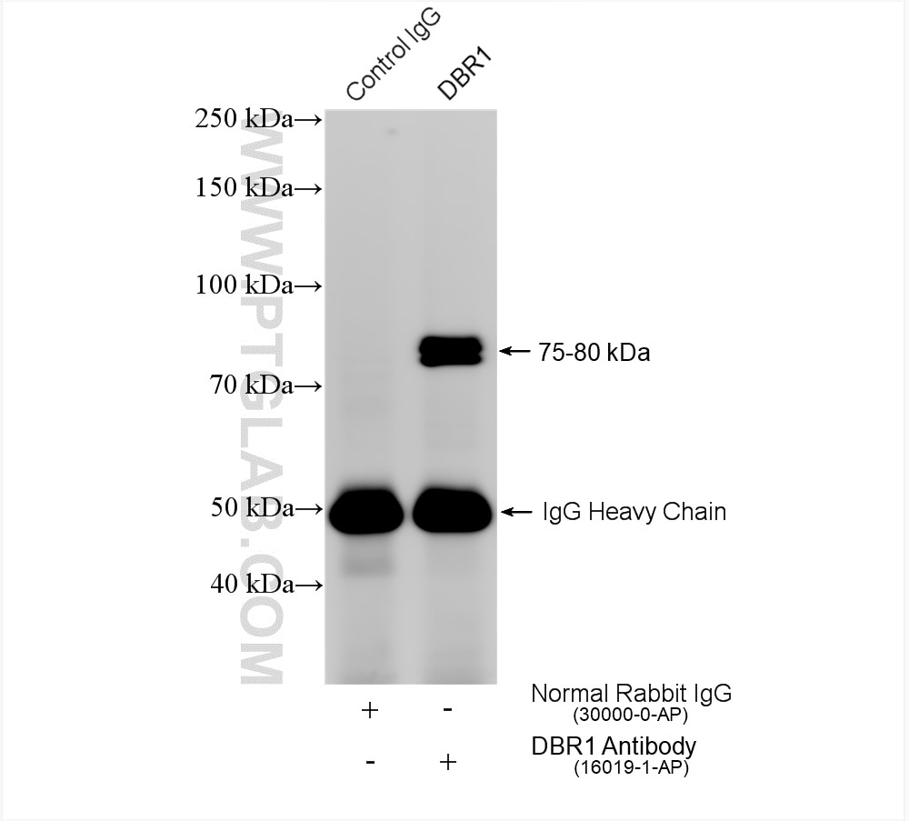 Immunoprecipitation (IP) experiment of mouse brain tissue using DBR1 Polyclonal antibody (16019-1-AP)