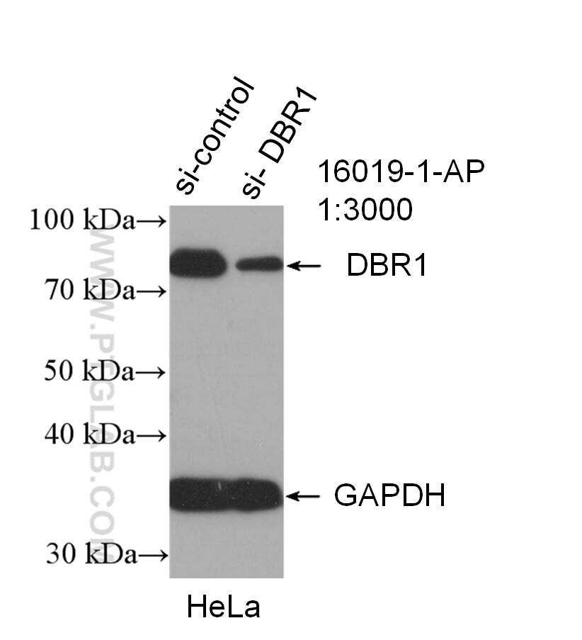 Western Blot (WB) analysis of HeLa cells using DBR1 Polyclonal antibody (16019-1-AP)
