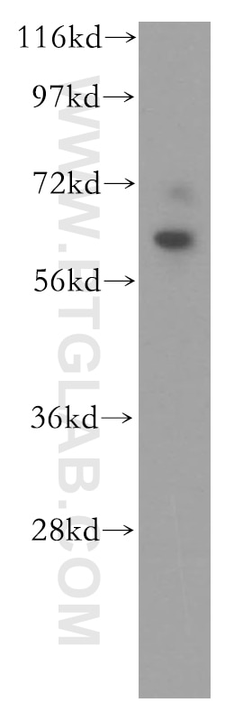 Western Blot (WB) analysis of human brain tissue using DBR1 Polyclonal antibody (16019-1-AP)