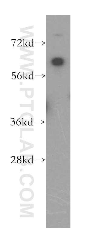 Western Blot (WB) analysis of HepG2 cells using DBR1 Polyclonal antibody (16019-1-AP)