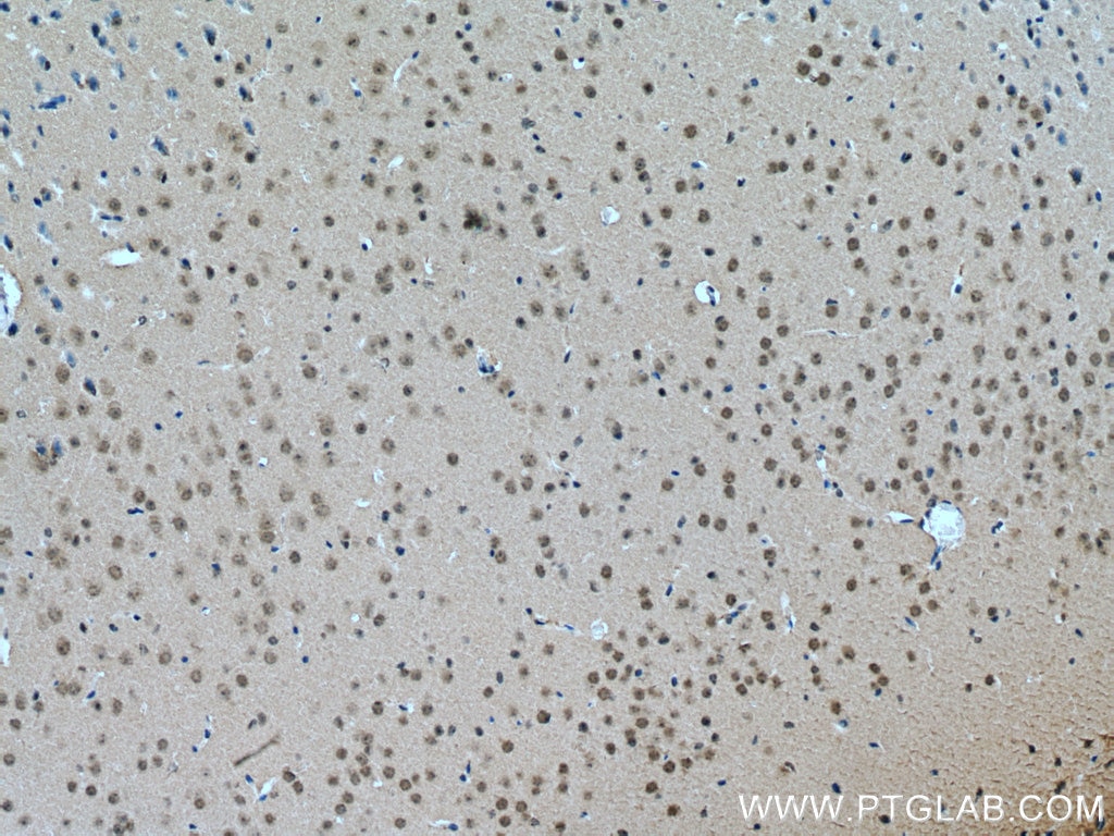 Immunohistochemistry (IHC) staining of mouse brain tissue using DBR1 Monoclonal antibody (66951-1-Ig)