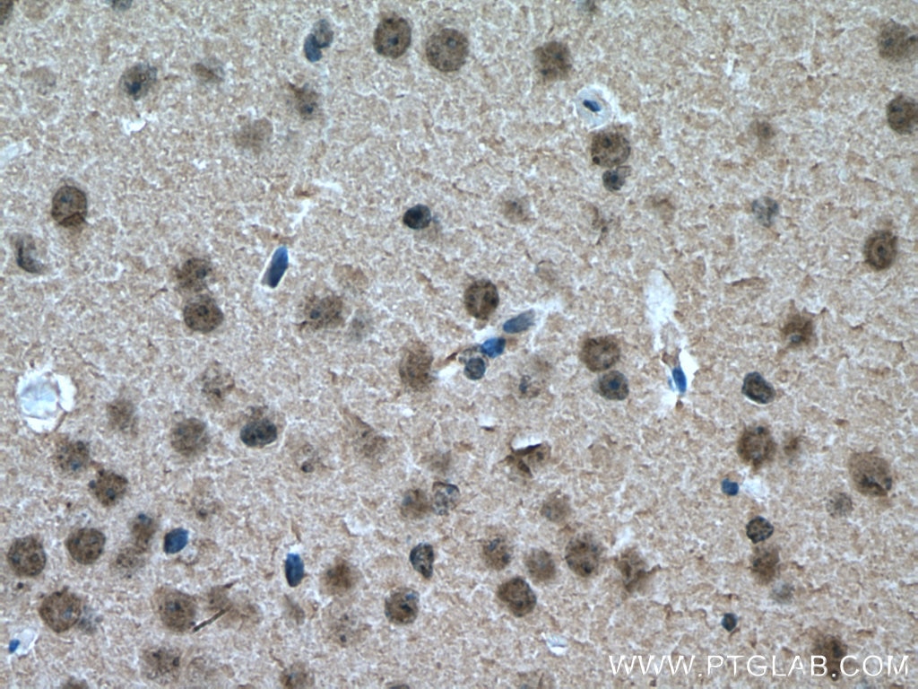 Immunohistochemistry (IHC) staining of mouse brain tissue using DBR1 Monoclonal antibody (66951-1-Ig)