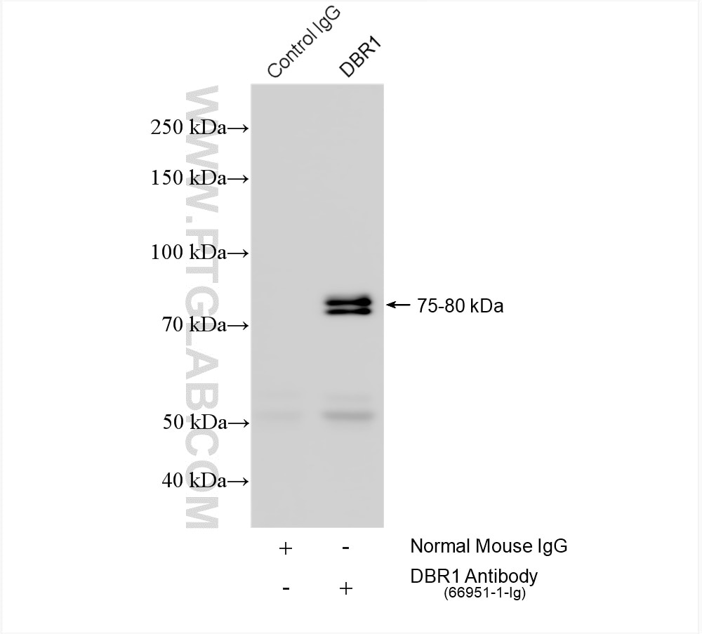 Immunoprecipitation (IP) experiment of mouse brain tissue using DBR1 Monoclonal antibody (66951-1-Ig)