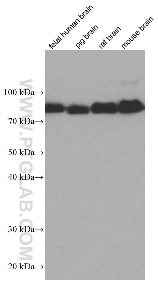 Western Blot (WB) analysis of various lysates using DBR1 Monoclonal antibody (66951-1-Ig)