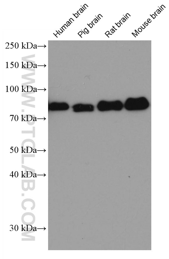 Western Blot (WB) analysis of various lysates using DBR1 Monoclonal antibody (66951-1-Ig)