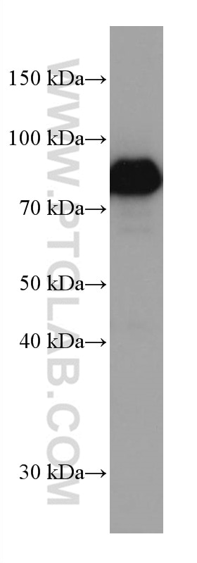 Western Blot (WB) analysis of MCF-7 cells using DBR1 Monoclonal antibody (66951-1-Ig)