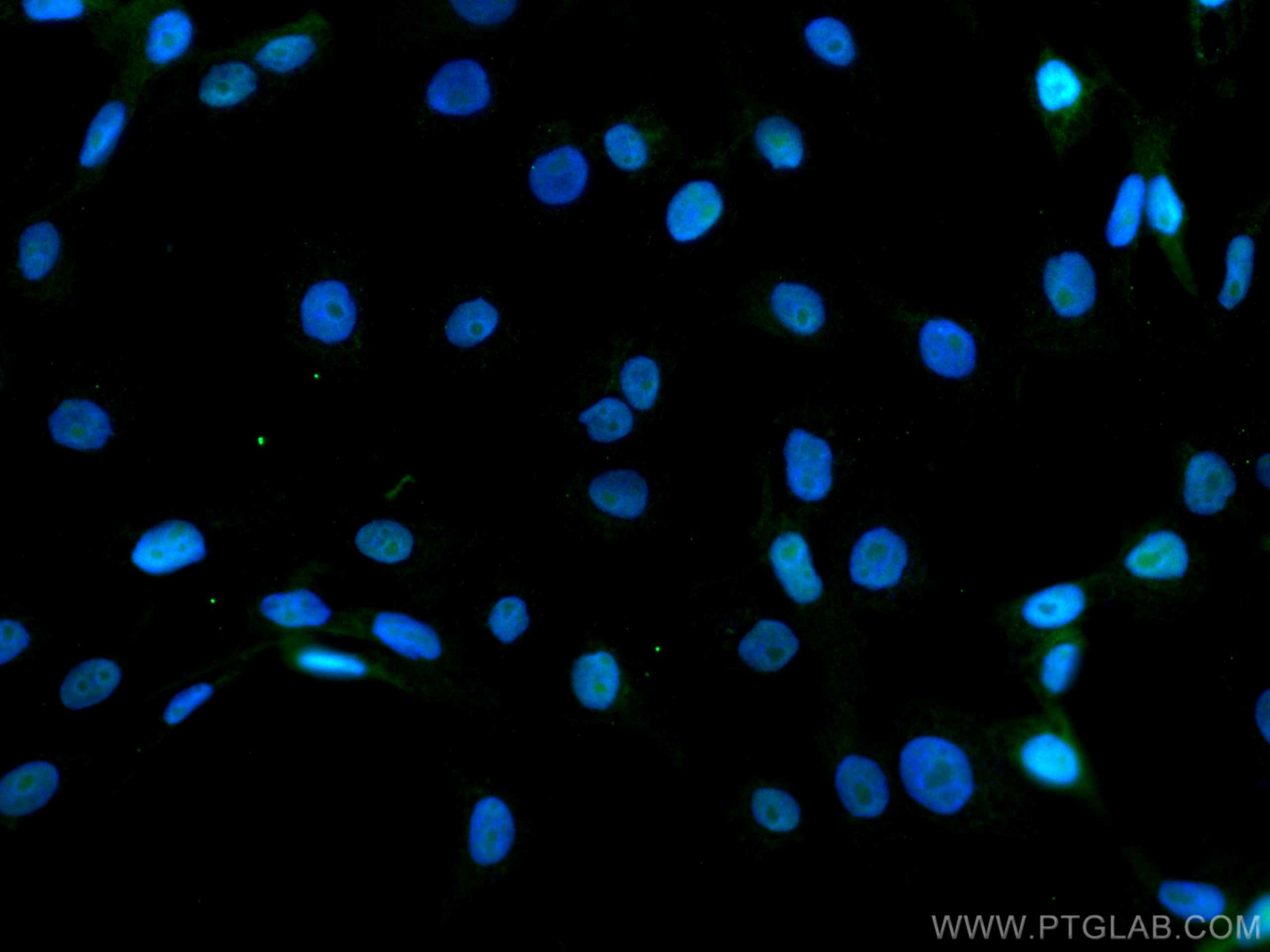 Immunofluorescence (IF) / fluorescent staining of A431 cells using CoraLite® Plus 488-conjugated DBR1 Monoclonal anti (CL488-66951)