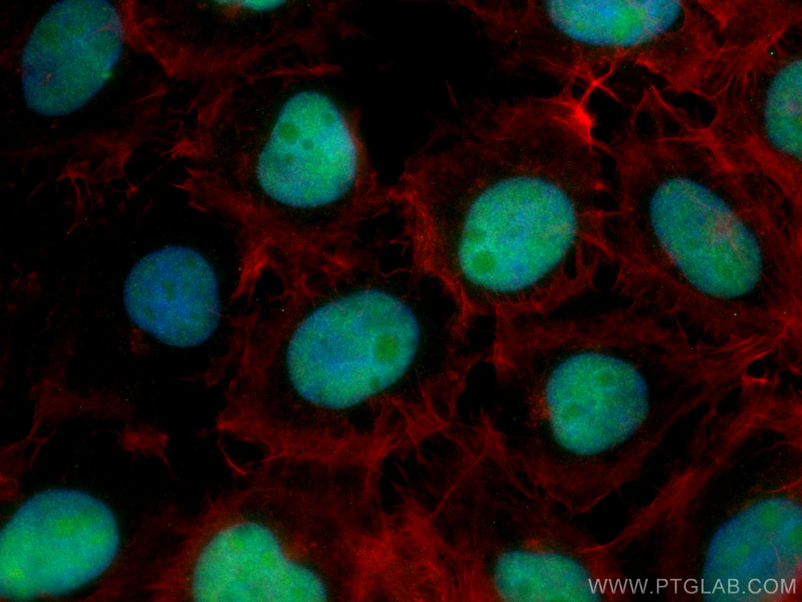 Immunofluorescence (IF) / fluorescent staining of A431 cells using CoraLite® Plus 488-conjugated DBR1 Monoclonal anti (CL488-66951)