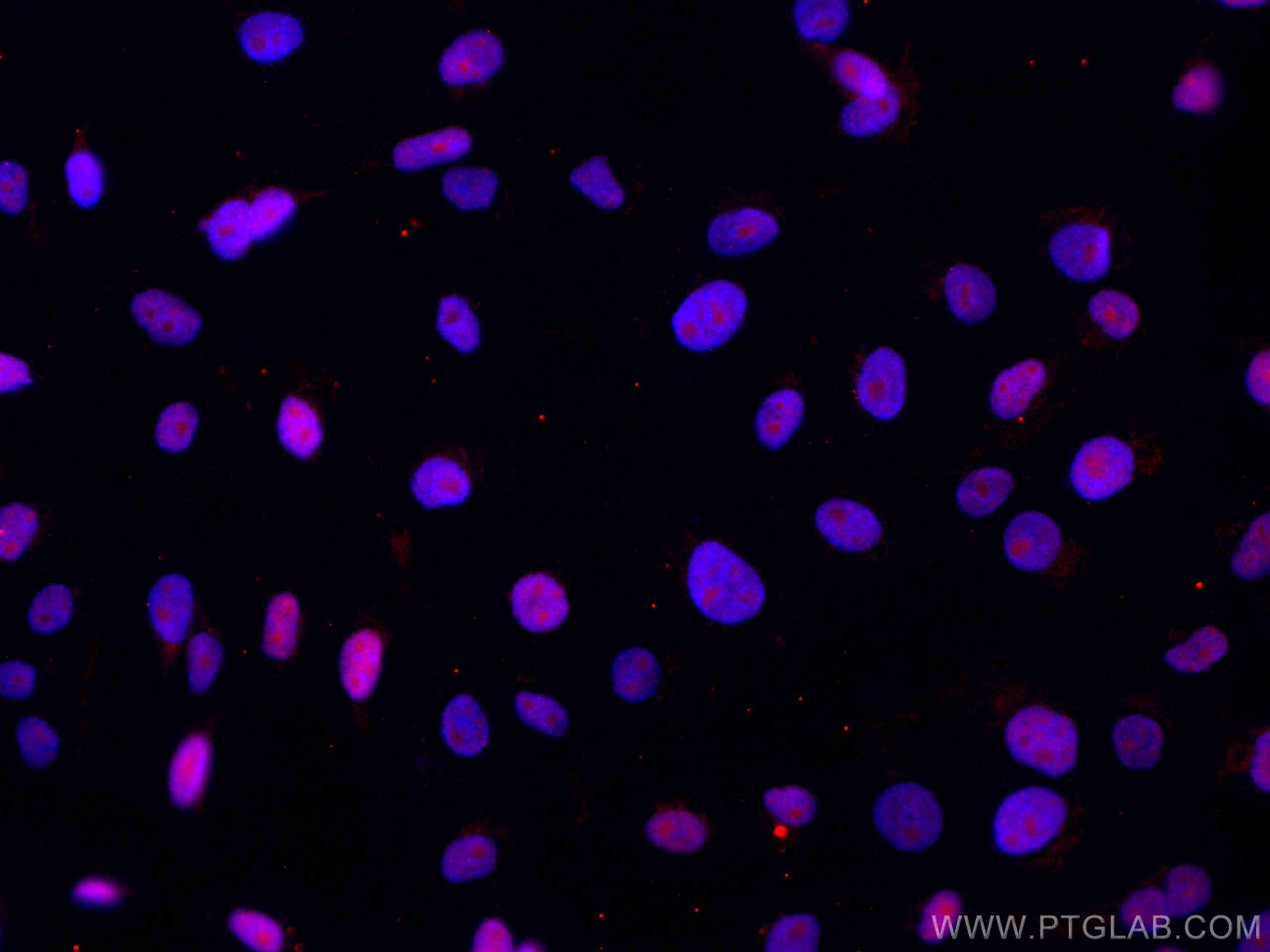 Immunofluorescence (IF) / fluorescent staining of A431 cells using CoraLite®594-conjugated DBR1 Monoclonal antibody (CL594-66951)