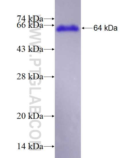 DBR1 fusion protein Ag8830 SDS-PAGE