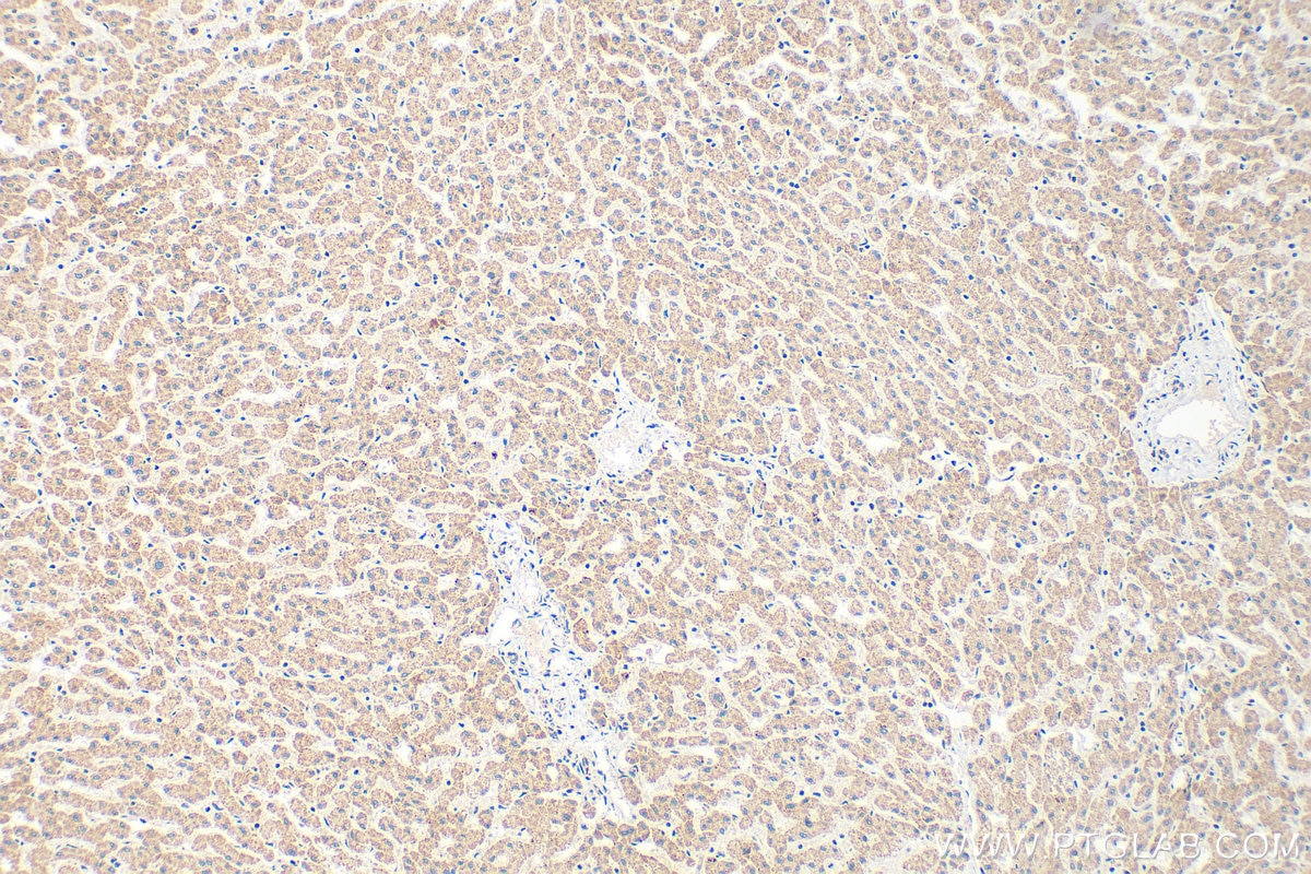 Immunohistochemistry (IHC) staining of human liver tissue using DBT Polyclonal antibody (12451-1-AP)