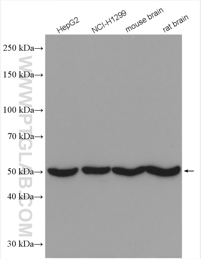 Western Blot (WB) analysis of various lysates using DBT Polyclonal antibody (12451-1-AP)