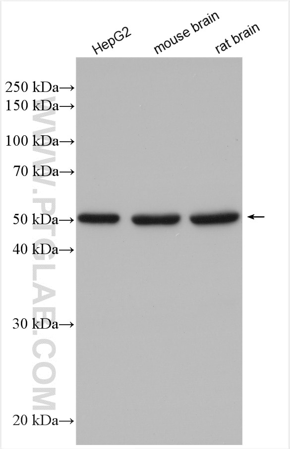 Western Blot (WB) analysis of various lysates using DBT Polyclonal antibody (12451-1-AP)