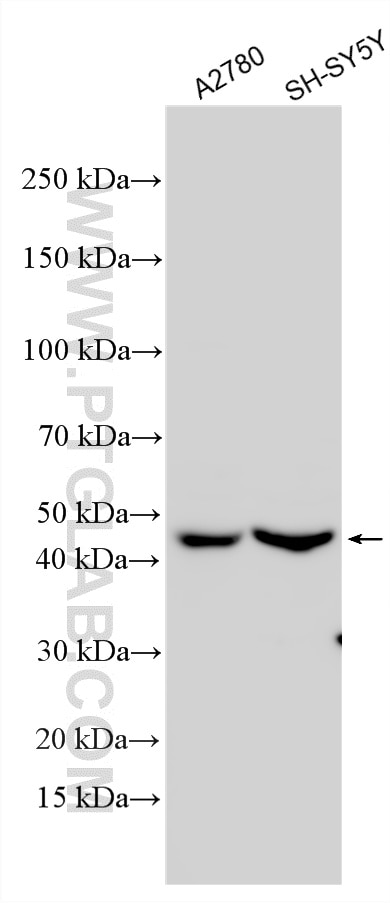 WB analysis using 33935-1-AP (same clone as 33935-1-PBS) Western Blot (WB) analysis of various lysates using DBX1 Polyclonal antibody (33935-1-AP)