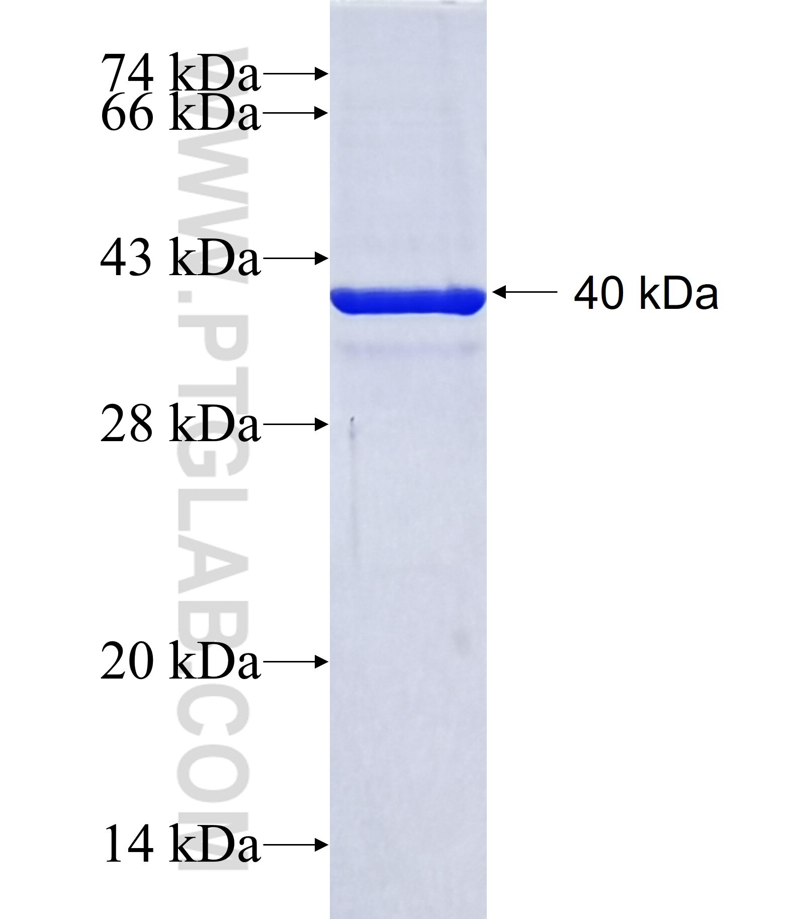 DBX1 fusion protein Ag40954 SDS-PAGE