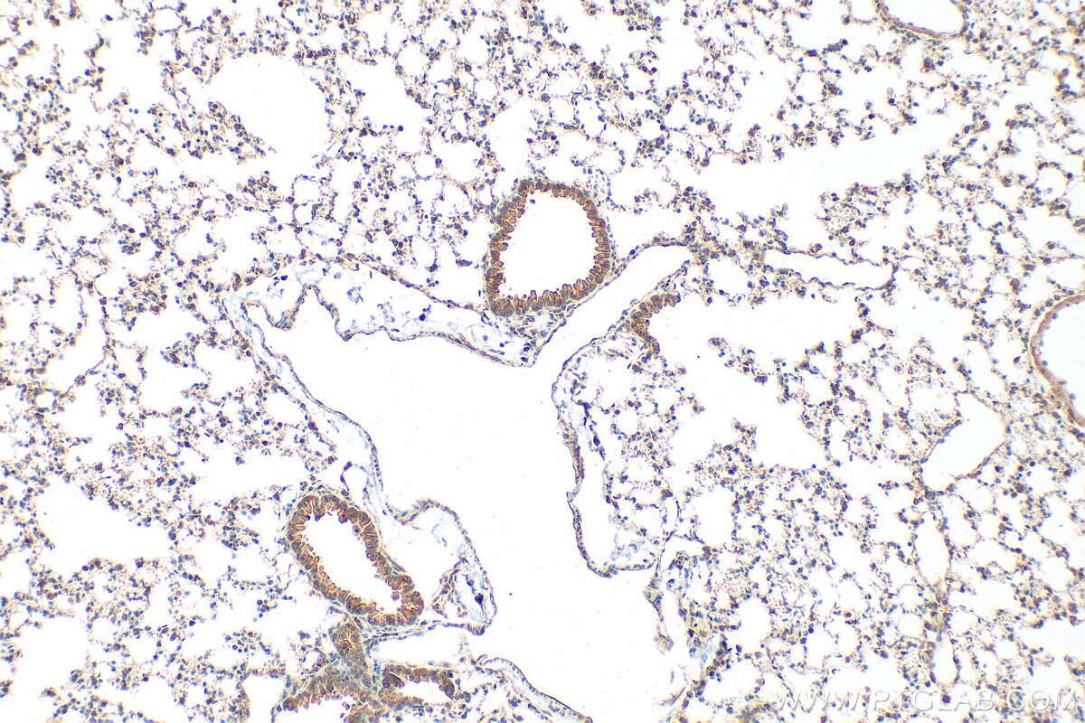 Immunohistochemistry (IHC) staining of mouse lung tissue using DCBLD1 Polyclonal antibody (24504-1-AP)