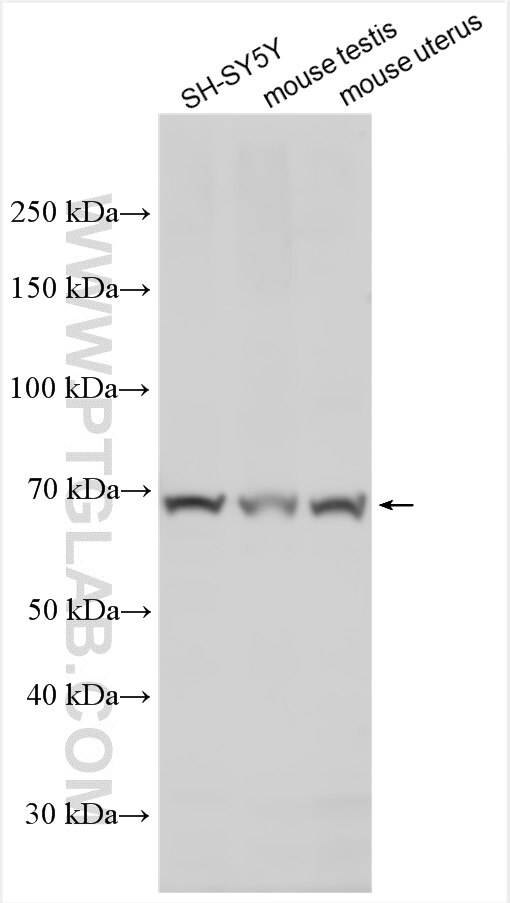 Western Blot (WB) analysis of various lysates using DCBLD1 Polyclonal antibody (24504-1-AP)