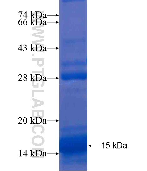 DCBLD1 fusion protein Ag21352 SDS-PAGE