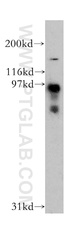 Western Blot (WB) analysis of human liver tissue using DCBLD2 Polyclonal antibody (13168-1-AP)