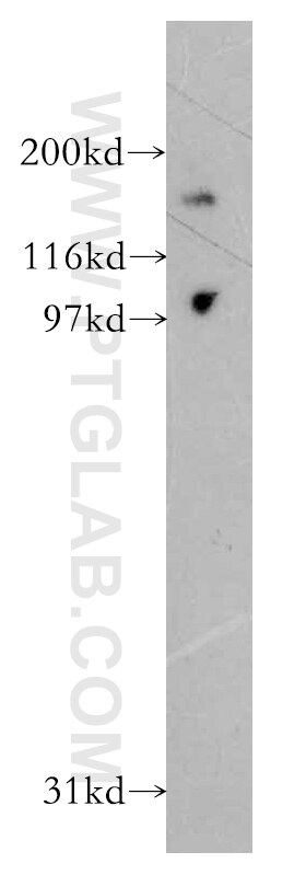 Western Blot (WB) analysis of human brain tissue using DCBLD2 Polyclonal antibody (13168-1-AP)