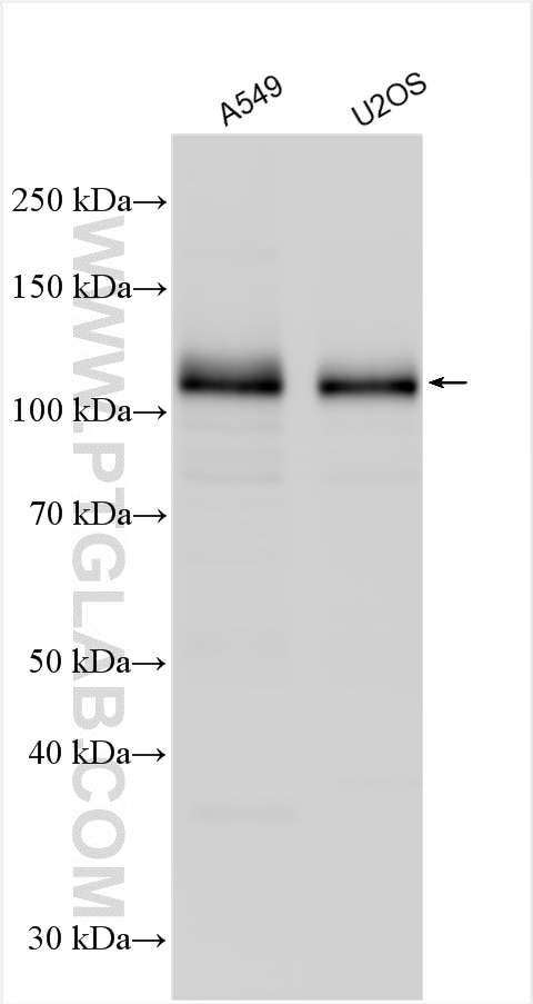 Western Blot (WB) analysis of various lysates using DCBLD2 Polyclonal antibody (30245-1-AP)